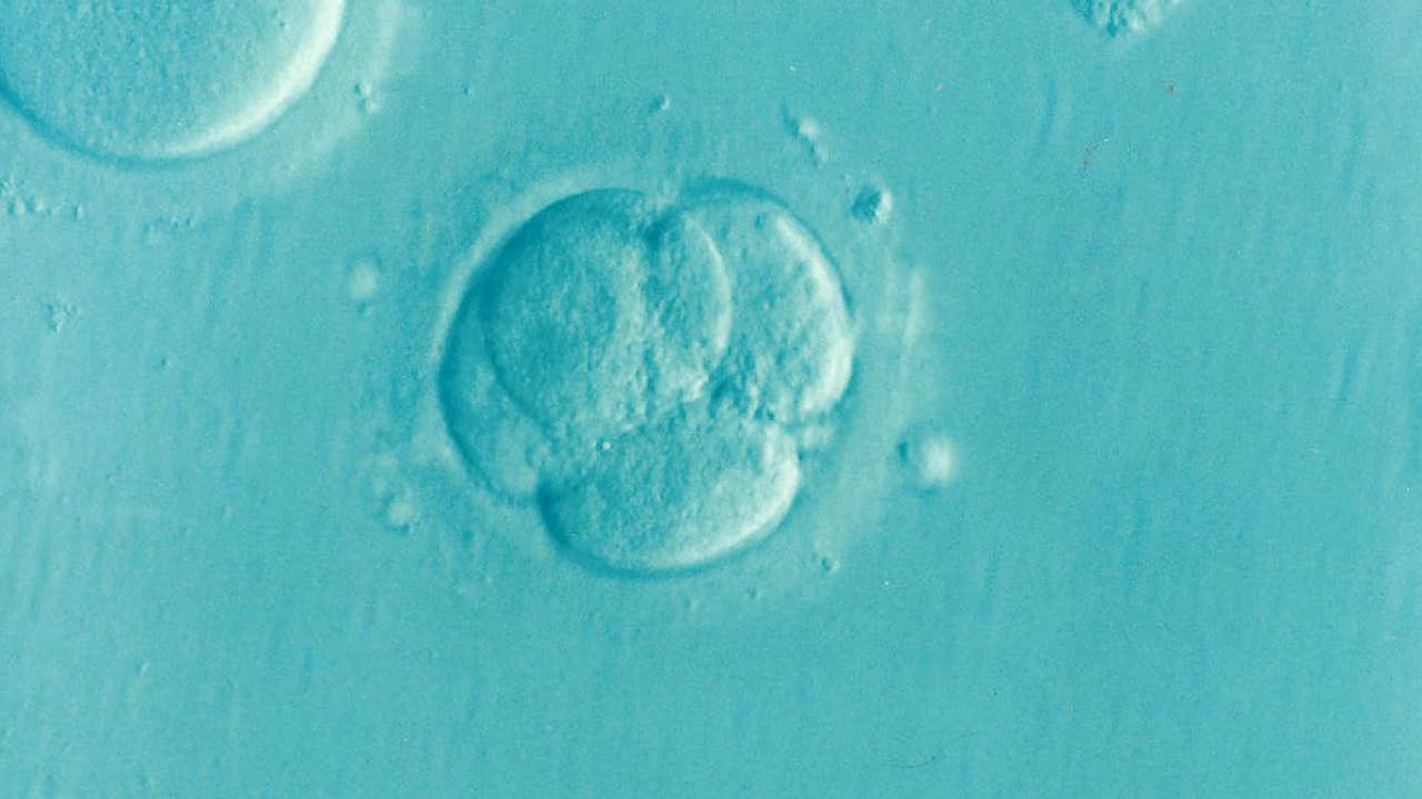 embryo, ivf, microfertilization